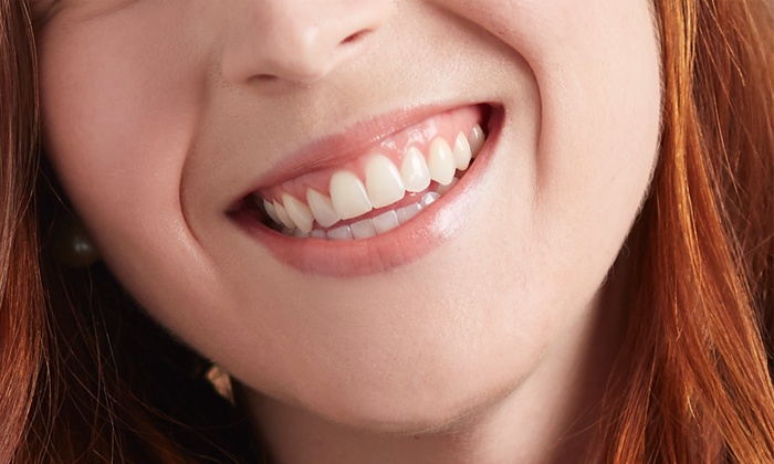 Gum recession treatments image