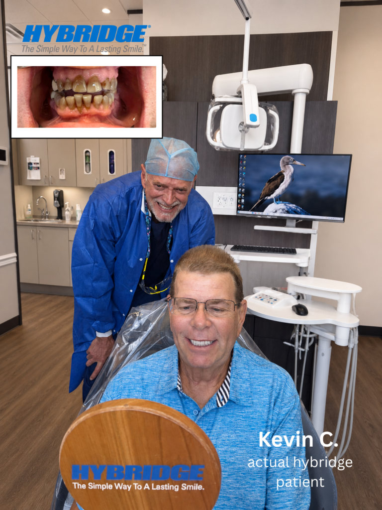Hybridge full-arch dental implant photo 2